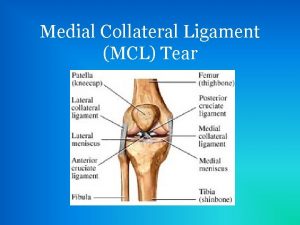 Medial Collateral Ligament MCL Tear Development of MCL