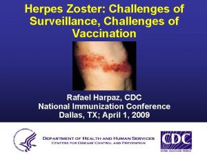 Herpes Zoster Challenges of Surveillance Challenges of Vaccination