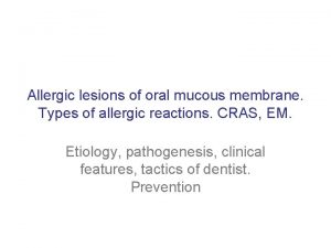 Allergic lesions of oral mucous membrane Types of