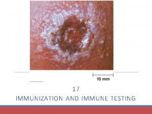 17 IMMUNIZATION AND IMMUNE TESTING Immunization Two Artificial
