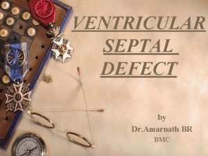 VENTRICULAR SEPTAL DEFECT by Dr Amarnath BR BMC