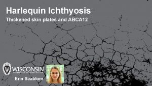 Harlequin Ichthyosis Thickened skin plates and ABCA 12