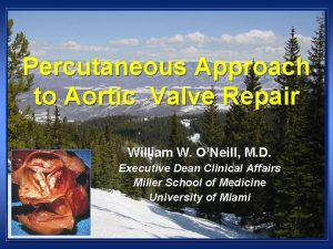 Percutaneous Approach to Aortic Valve Repair William W