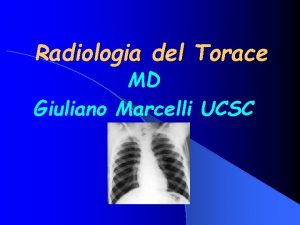 Radiologia del Torace MD Giuliano Marcelli UCSC Making