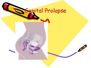 Genital Prolapse UTREUS Aetiology of prolapse 1 2