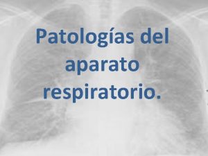 Patologas del aparato respiratorio Clasificacin Procesos inflamatorios de