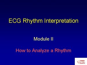 ECG Rhythm Interpretation Module II How to Analyze