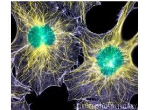 Video clip ENDOMEMBRANE SYSTEM Definition of ENDOMEMBRANE SYSYTEM