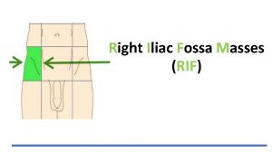 Right Iliac Fossa Masses RIF RIGHT ILLIAC FOSSA