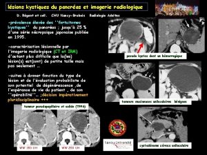 lsions kystiques du pancras et imagerie radiologique D