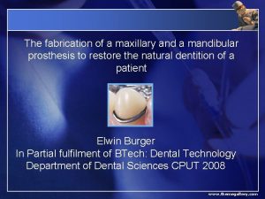 The fabrication of a maxillary and a mandibular