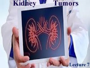 Kidney Tumors Lecture 7 Kidney Tumors v Benign