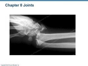 Chapter 8 Joints Copyright 2010 Pearson Education Inc