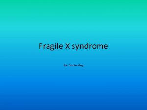 Fragile X syndrome By Dustin King Who gets
