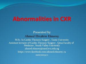 Abnormalities in CXR Presented by Ahmed Ebrahim Elmorsy