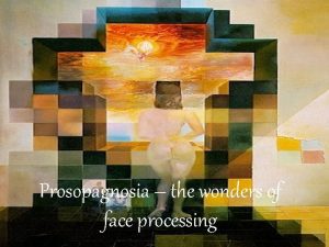Prosopagnosia the wonders of face processing BITS AND
