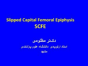 Slipped Capital Femoral Epiphyses INCIDENCE AND EPIDEMIOLOGY The