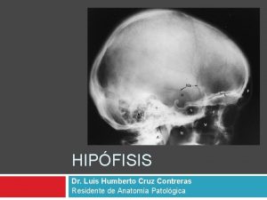 HIPFISIS Dr Luis Humberto Cruz Contreras Residente de