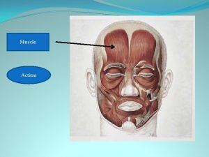 Frontalis Muscle Raises eyebrows Action A Muscle Zygomaticus