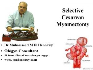 Selective Cesarean Myomectomy Dr Muhammad M El Hennawy