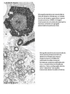 Autor Elliot W Kitajima Micrografia eletrnica de transmisso