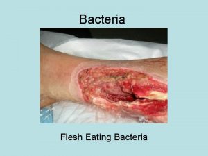 Bacteria Flesh Eating Bacteria What are the two