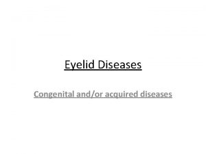 Eyelid Diseases Congenital andor acquired diseases Congenital Diseases