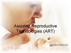 Assisted Reproductive Technologies ART Jelena Marui Assisted Reproductive