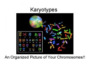 Karyotypes An Organized Picture of Your Chromosomes Creating