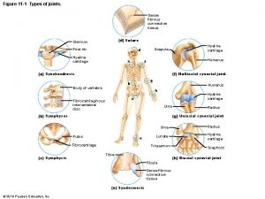Figure 11 1 Types of joints Dense fibrous