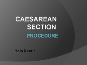 CAESAREAN SECTION PROCEDURE Hala Nsour Contents CONSENT PREPARATION