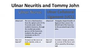 Ulnar Neuritis and Tommy John Ulnar Nerve Ulnar