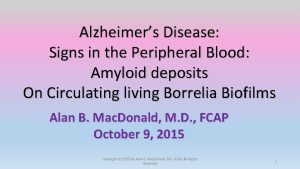 Alzheimers Disease Signs in the Peripheral Blood Amyloid