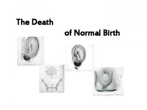 The Death of Normal Birth The Death of