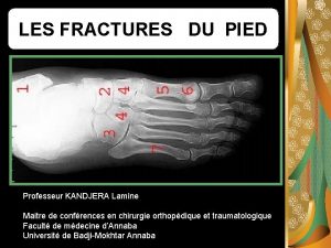 LES FRACTURES DU PIED Professeur KANDJERA Lamine Maitre