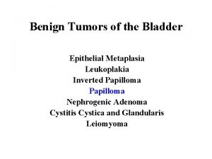 Benign Tumors of the Bladder Epithelial Metaplasia Leukoplakia