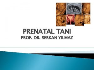 PRENATAL TANI PROF DR SERKAN YILMAZ Doumncesi tan