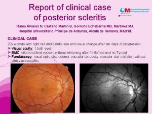 Report of clinical case of posterior scleritis Rubio