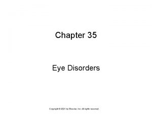 Chapter 35 Eye Disorders Copyright 2021 by Elsevier