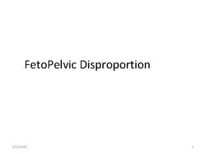 Feto Pelvic Disproportion 2122022 1 Outlines Definition Etiology