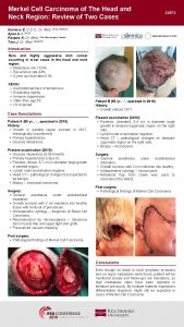 Merkel Cell Carcinoma of The Head and Neck