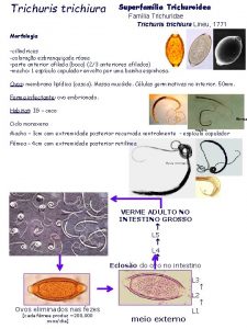 Trichuris trichiura Superfamlia Trichuroidea Famlia Trichuridae Trichuris trichiura