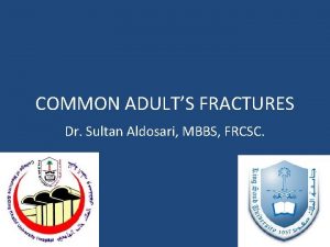 COMMON ADULTS FRACTURES Dr Sultan Aldosari MBBS FRCSC
