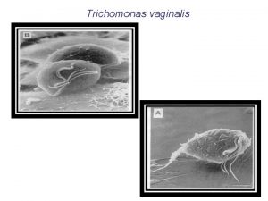 Trichomonas vaginalis Es un protozoo flagelado de amplia