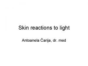 Skin reactions to light Antoanela arija dr med