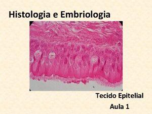 Histologia e Embriologia Tecido Epitelial Aula 1 Histologia