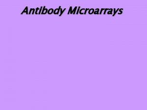 Antibody Microarrays Antibody Ab Microarray A complete microarraybased