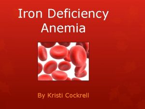 Iron Deficiency Anemia By Kristi Cockrell Why I