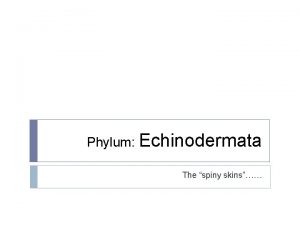 Phylum Echinodermata The spiny skins General Information What
