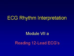ECG Rhythm Interpretation Module VII a Reading 12
